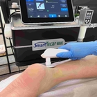 Enríe la onda de Smart Tecar de la máquina del alivio del dolor del equipo de la fisioterapia del Cet Rf