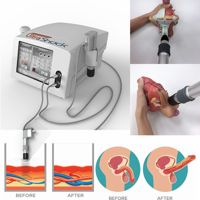 Máquina neumática de la terapia de la onda de choque de 12 cabezas para el esguince del tobillo