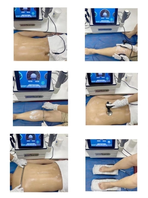 3 en 1 máquina de la onda de choque de la diatermia el ccsme de Tecar para la fisioterapia del cuerpo para lesión del deporte y el efecto de las celulitis