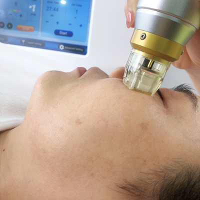 10,4” ajustes fraccionarios de la piel de la elevación de cara de Microneedling RF